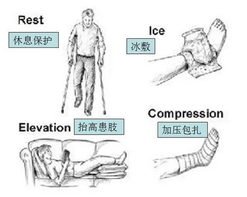 脚扭伤的正确处理方法，从急救到恢复的全面指南